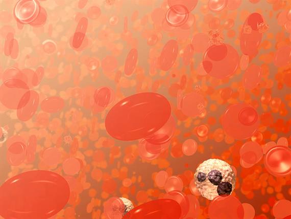 L'Anemia Falciforme risale davvero ad un singolo bambino, nato 7300 anni fa?