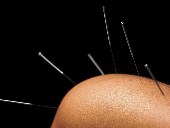 Agopuntura: effetti antinfiammatori attraverso il nervo vago