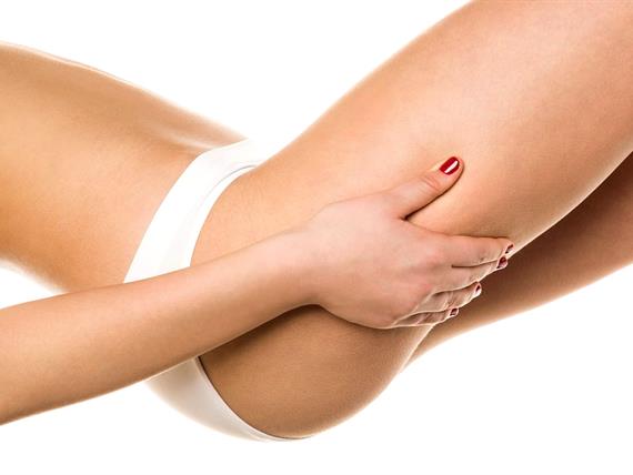 Cellulite: Verità e Concretezza dei Rimedi Terapeutici