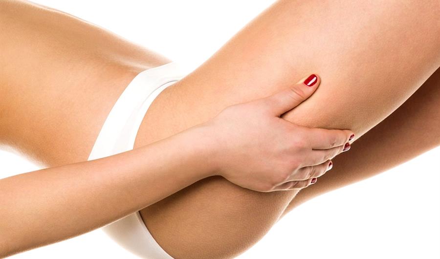 Cellulite: Verità e Concretezza dei Rimedi Terapeutici